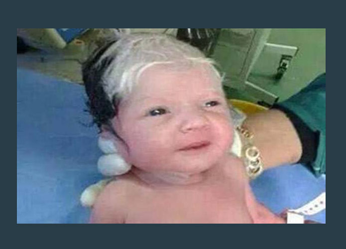 الجمهورية ولادة طفل في لبنان بشعر شايب